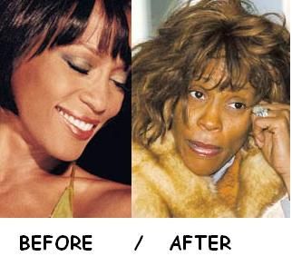 The famous singer Whitney Houston is only skin and bones Whitney Houston is suffering from severe weight issues