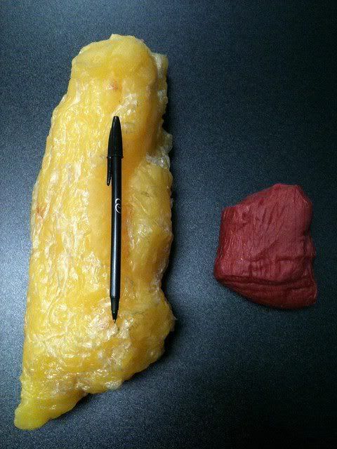 5 pounds of fat compared with 5 pounds of muscle